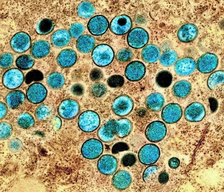 Вспышка оспы обезьян: ВОЗ объявляет международную чрезвычайную ситуацию