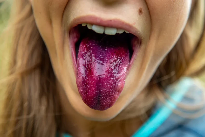 Язык как зеркало здоровья: древняя диагностика в цифровую эпоху