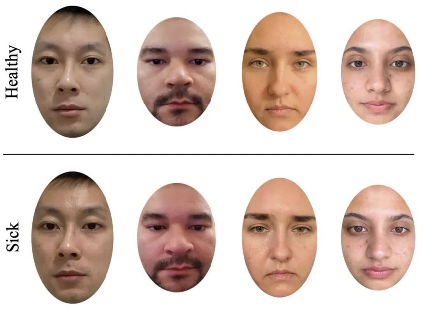 Почему женщины точнее распознают болезнь по лицу: объяснение учёных