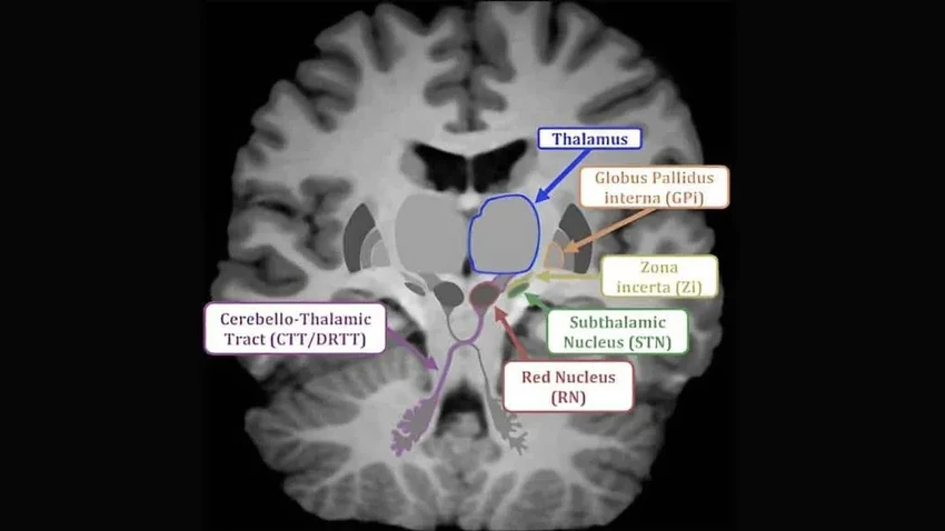 Как мозг создает связь с матерью: открыты уникальные нейроны детской привязанности