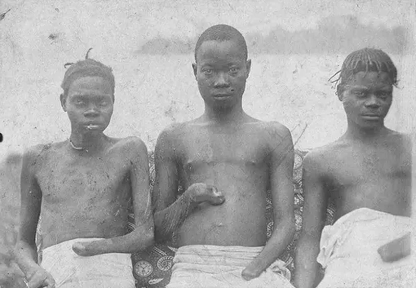 Король Леопольд II: как частная колония в Конго стала страной ужаса