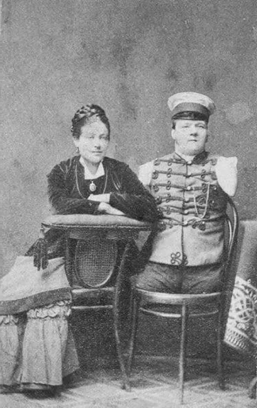 Невероятная история Николая Кобелькова: от рождения без конечностей до миллионера