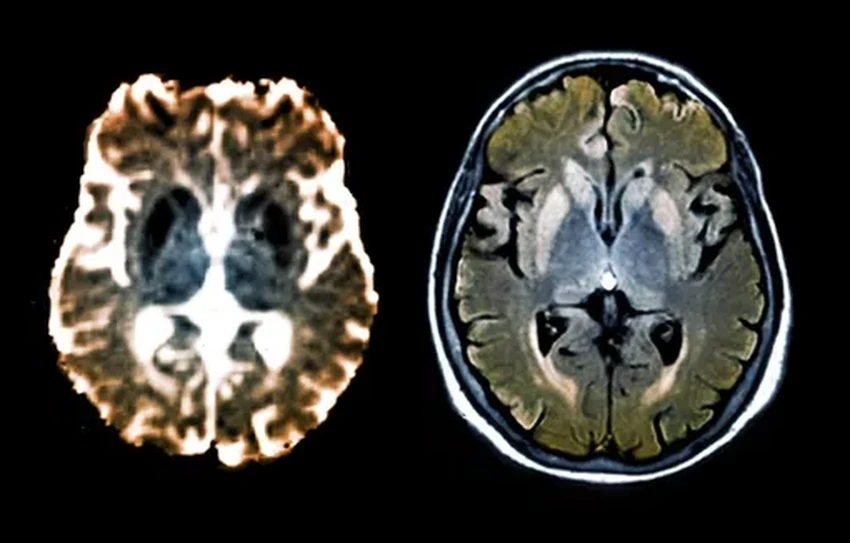Мы — симбиоз клеток и бактерий: главные открытия недели
