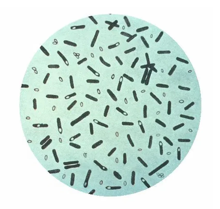 Массовое отравление в Москве: консервированная фасоль как причина вспышки ботулизма