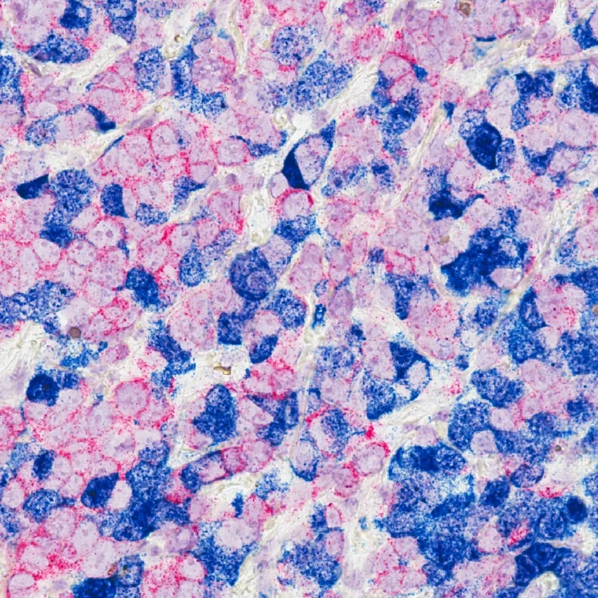 Как голодание помогает иммунитету бороться с раковыми клетками