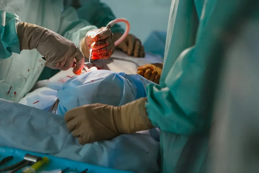 Артемизинин против СПКЯ: как древнее лекарство помогает при поликистозе