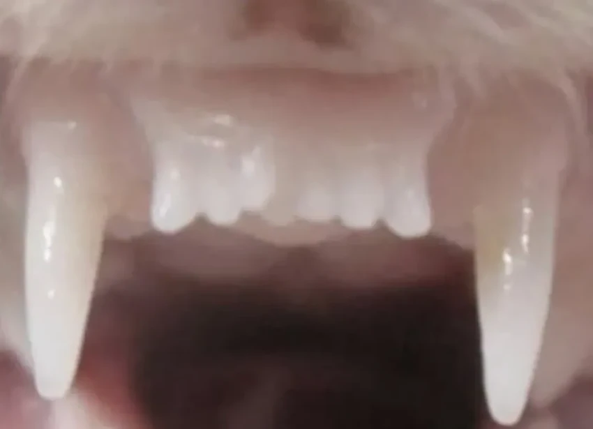 Испытания на людях: препарат для роста новых зубов выходит на новый этап