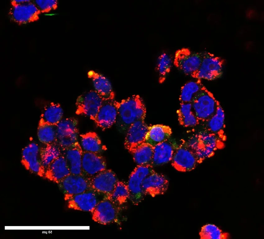 Наночастицы против детского рака мозга: как железо пробивает барьер