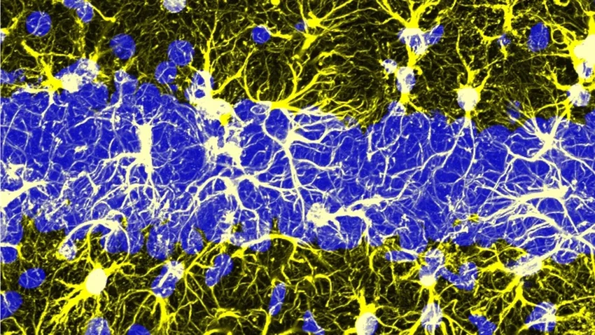 Нейробиология недели: карта мозга, память и заморозка ткани