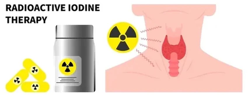 Гипертиреоз: скрытые симптомы, когда срочно нужен эндокринолог