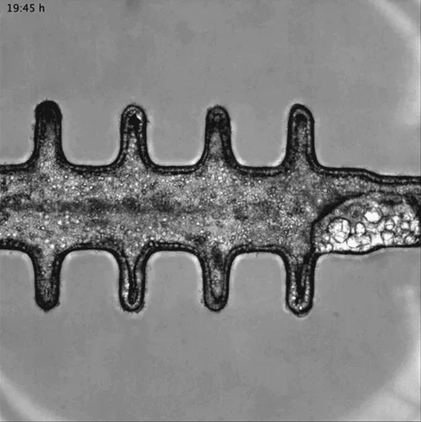 Прорыв в медицине: как живые модели мозга и кишечника борются с раком