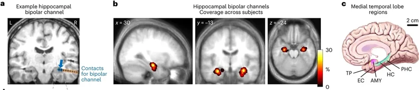 Как мозг запоминает, где что лежит: тайны пространственной памяти