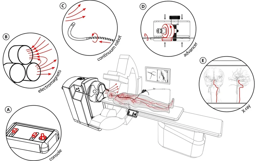 Магнитный робот-спасатель: как он очищает сосуды от тромба при инсульте