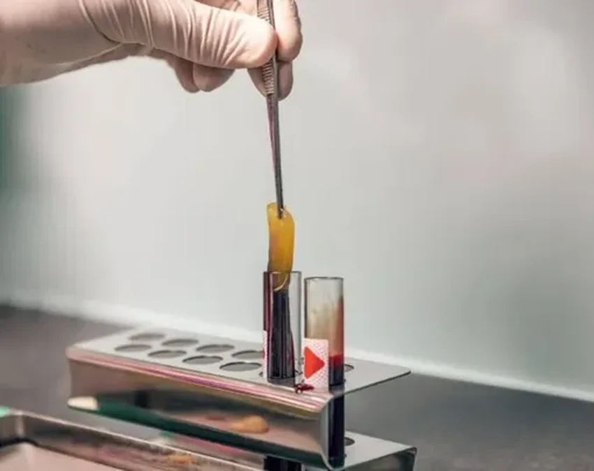 Новая технология: как мембрана из вашей крови ускоряет заживление после удаления зуба