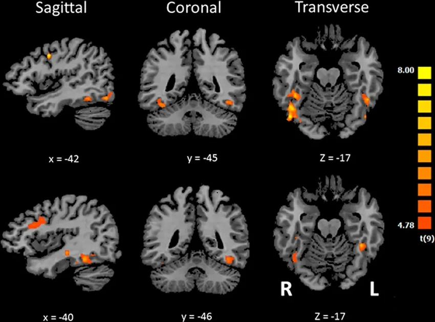 Мозг слепых «видит» лица ушами: как звук заменяет зрение для распознавания
