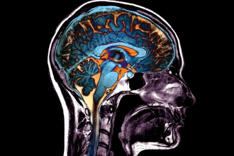Старение мозга: учёные обнаружили пять разных сценариев угасания разума