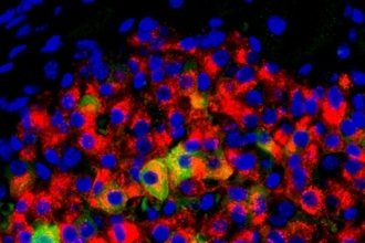 Адипсин: как белок из жира защищает от диабета