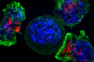 Новый метод анализа рака простаты для точного прогноза рецидивов