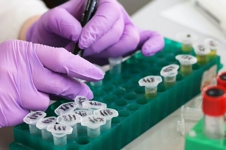 Ранняя диагностика атеросклероза: какой белок в крови выдаёт болезнь