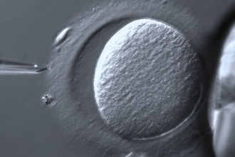 Ребёнок от трёх родителей: как работает эта технология и в чём спор?