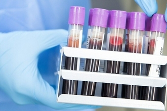 Новый анализ крови для ранней диагностики рака поджелудочной железы