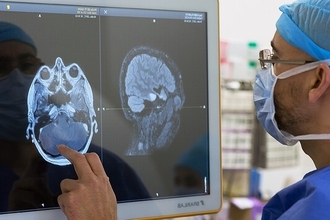 Прорыв в лечении глиобластомы: перспективный препарат RIPGBM