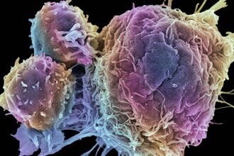 Новые клетки Co-STAR: полное уничтожение опухолей у мышей. Будущее терапии