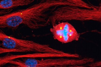 Ученые нашли молекулу, которая замедляет внутренние часы раковых клеток