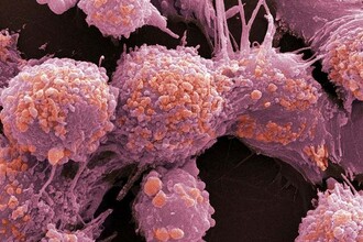 Универсальная иммунотерапия рака: как лечат метастазы