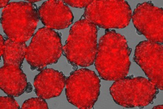 Выращенные бета-клетки научились точно контролировать сахар в крови