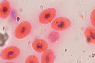 Созданы искусственные эритроциты: чем они лучше настоящих?