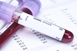 Новые возможности ранней диагностики рака: как технологии меняют прогноз