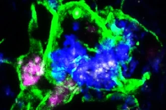 Активация иммунных клеток для очистки мозга от амилоидных бляшек