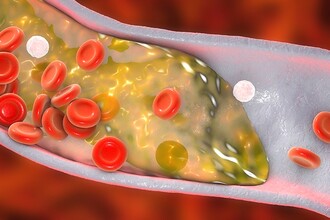 Фермент DGAT1: как он управляет «плохим» холестерином и риском атеросклероза