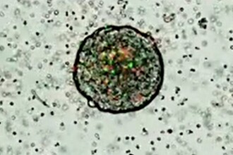 Универсальная мишень PAF: как одна молекула помогает многим видам рака