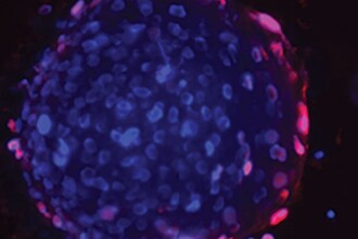 Неожиданная роль белка GP130 в борьбе с раком простаты