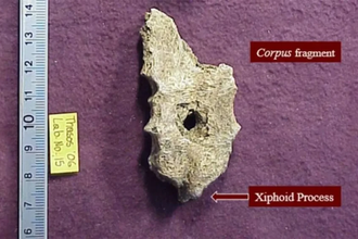 Тасосская загадка: как отверстие в груди раскрыло древнее убийство