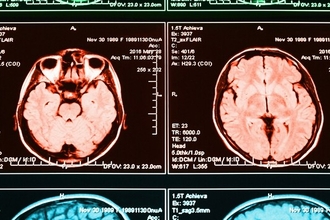 Почему мы злимся? Ученые нашли связь между гневом и работой двух сетей мозга