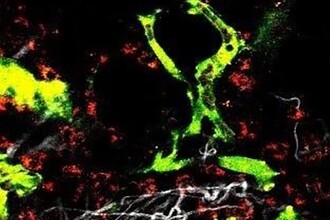 Можно ли обучить врождённый иммунитет атаковать раковые клетки?