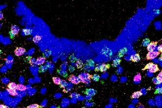 Как мозг решает, что вы сыты: найдены нейроны-регуляторы аппетита