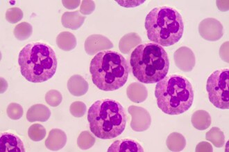 Вечные химикаты ПФАС: чем они опасны для иммунитета человека