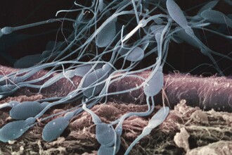 Управление полом потомства: новая технология сортировки сперматозоидов