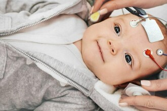 Ранняя диагностика аутизма: может ли обычный тест слуха новорожденных помочь?