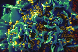 Новый «берлинский пациент»: седьмой человек в мире излечился от ВИЧ
