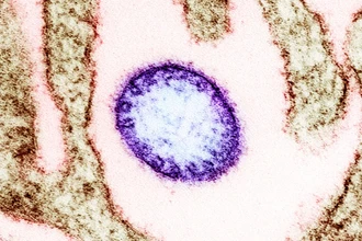 Новое антитело против вируса Нипах: испытания показали 100% выживаемость