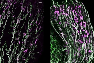 Как устроены тельца Краузе и почему они так важны для сексуального возбуждения