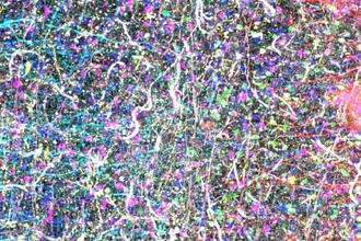 Нейробиология прорыв: как новое изображение мозга раскрывает тайну Альцгеймера