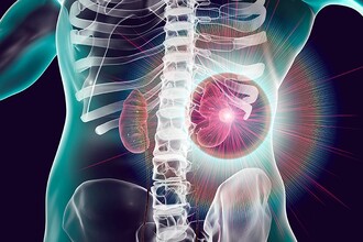 Как ИИ предсказывает отказ почек: новая эра диагностики