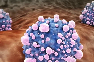 Рак поджелудочной железы: новая надежда в лечении опухоли