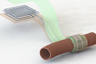 Сенсор для кровотока: как хирурги контролируют сосуды в реальном времени